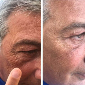 laumar-instantense-plus-elotte-utana-02