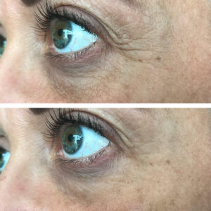 laumar-instantense-plus-elotte-utana-03