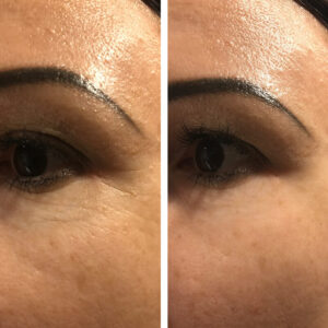 laumar-instantense-plus-elotte-utana-04