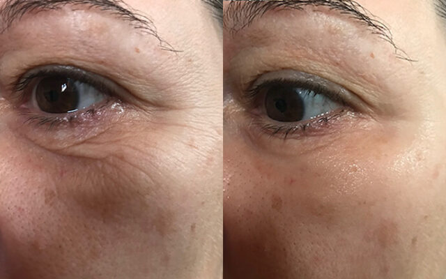 laumar instantense plus elotte utana 05