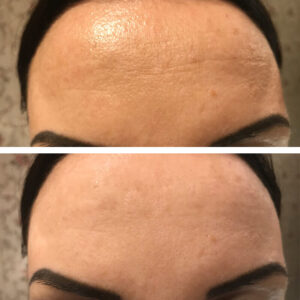 laumar-instantense-plus-elotte-utana-05