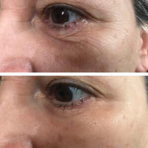 laumar-instantense-plus-elotte-utana-08