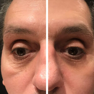 laumar-instantense-plus-elotte-utana-09