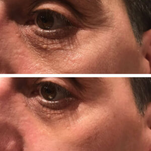 laumar-instantense-plus-elotte-utana-10