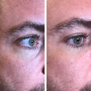 laumar-instantense-plus-elotte-utana-11