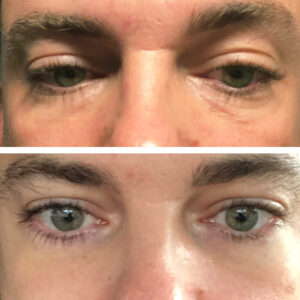 laumar-instantense-plus-elotte-utana-12