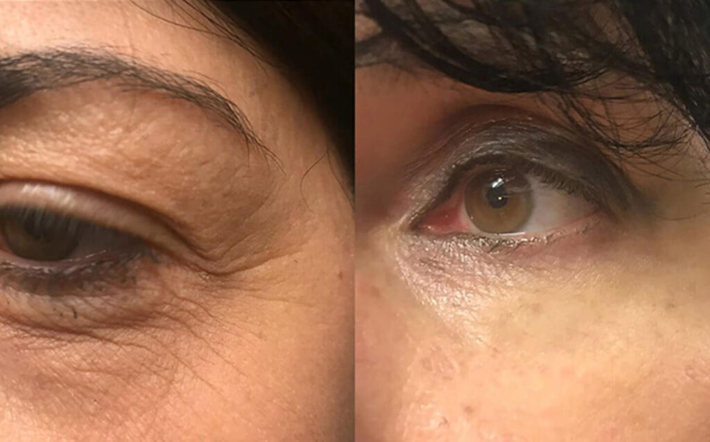 4-tevhit-a-6-10-oras azonnali hatas minden-esetben