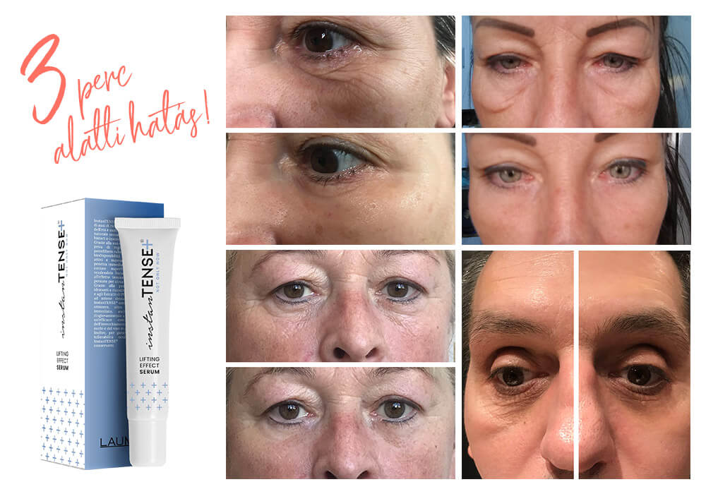 Laumar Instantense Plus szérum