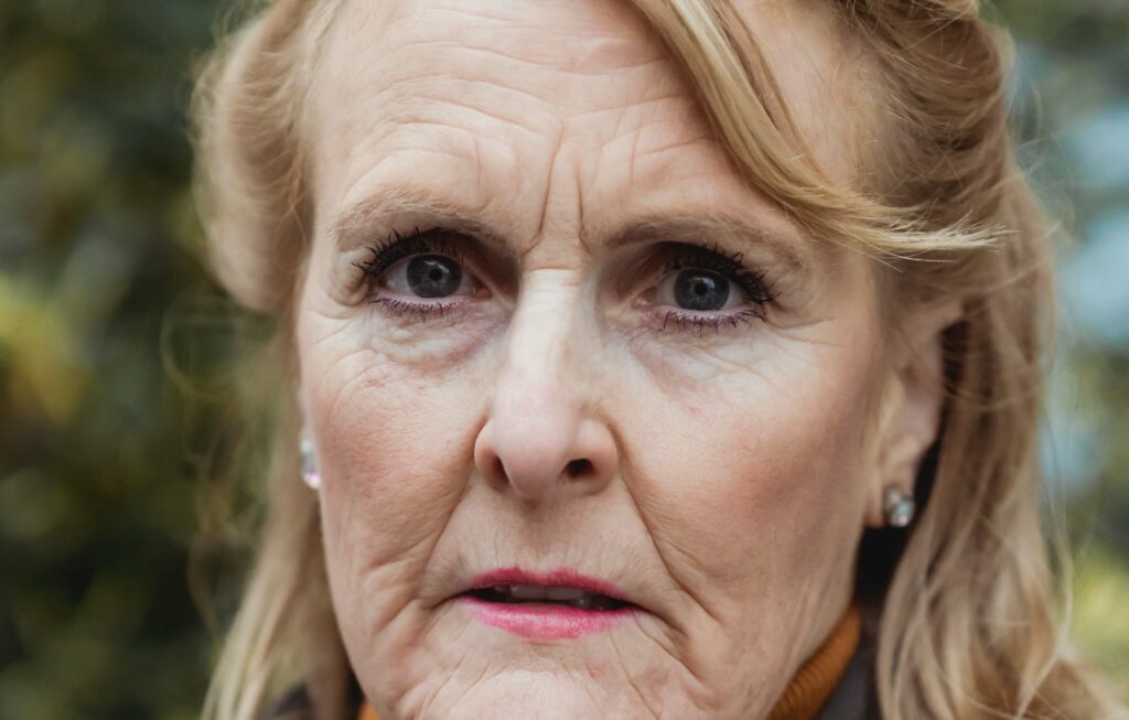 szem-alatti-karikak-szintol-fuggoen-akar-problemat-is-jelezhet